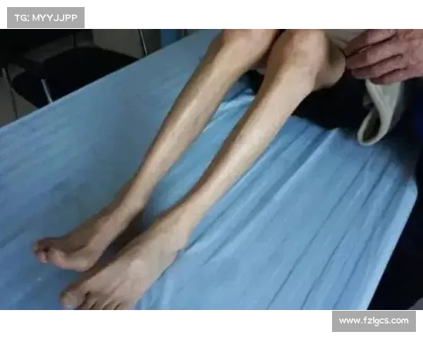 防止老人肌肉流失的关键:提前采取这方法(如何防止年老肌肉萎缩) 防止老人肌肉流失的关键:提前采取这方法(如何防止年老肌肉萎缩)